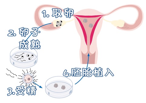 时差培养箱